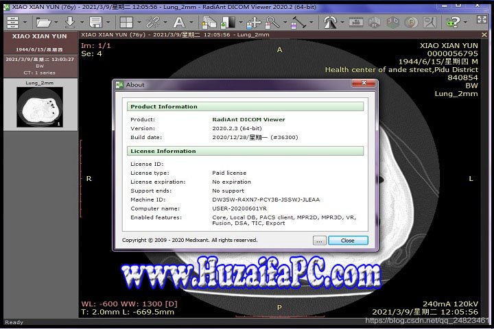 RadiAnt DICOM Viewer 2023.1 PC Software with Patch 
