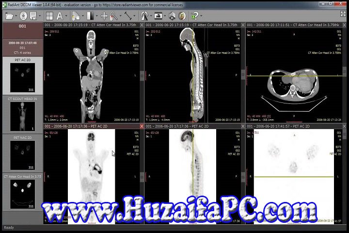 RadiAnt DICOM Viewer 2023.1 PC Software with Keygen